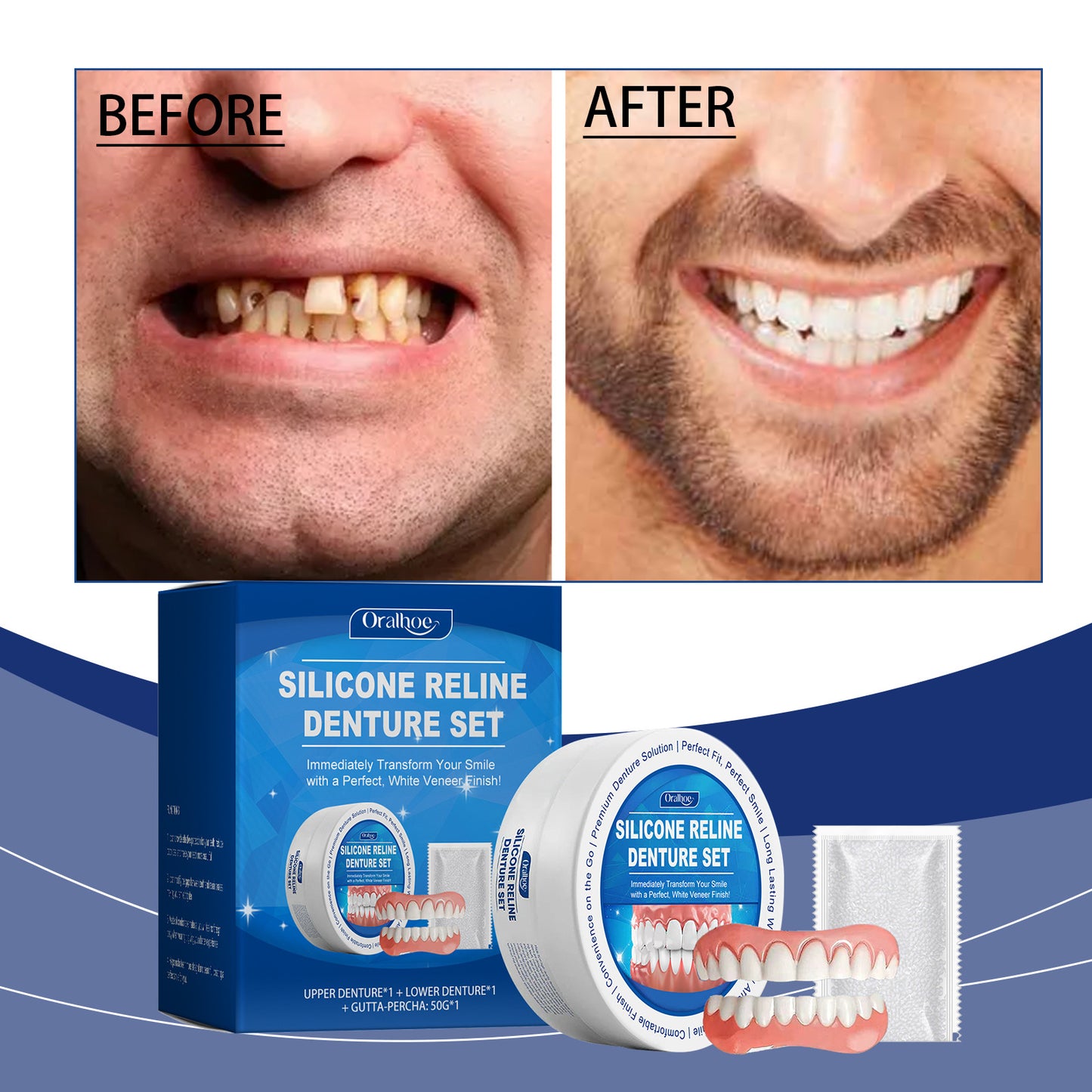 PerfectSmile™ Silicone Gebitsset